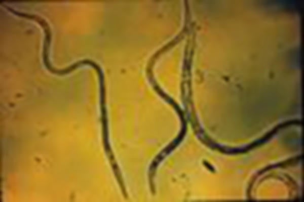 Nematodes (c) UCR