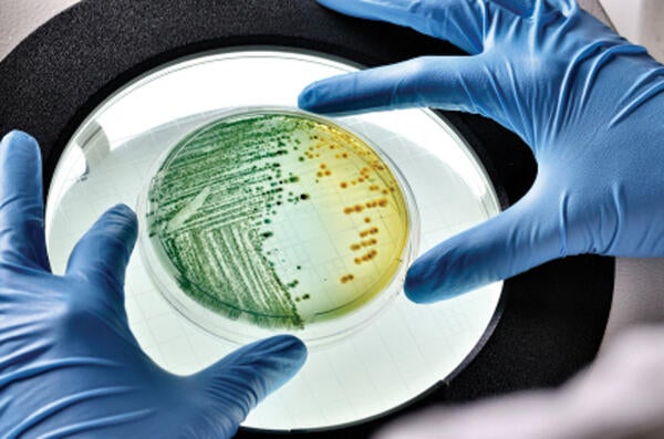 Undergraduate Majors Microbiology Micro E Coli