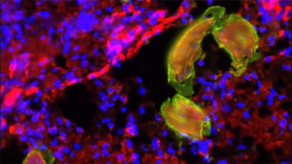CIDVR parasitic worm (c) UCR SOM CIDVR parasitic worm (c) UCR SOM