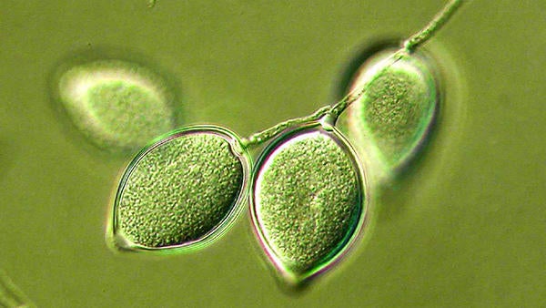 Phytophthora (c) UCR Phytophthora (c) UCR