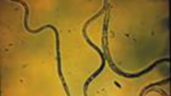 Nematodes (c) UCR Nematodes (c) UCR